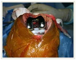 Slider image (8) Dr. A. K. Venkatachalam MJRC Clinic